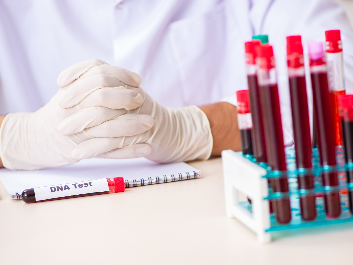 mẫu xét nghiệm ADN: mẫu máu