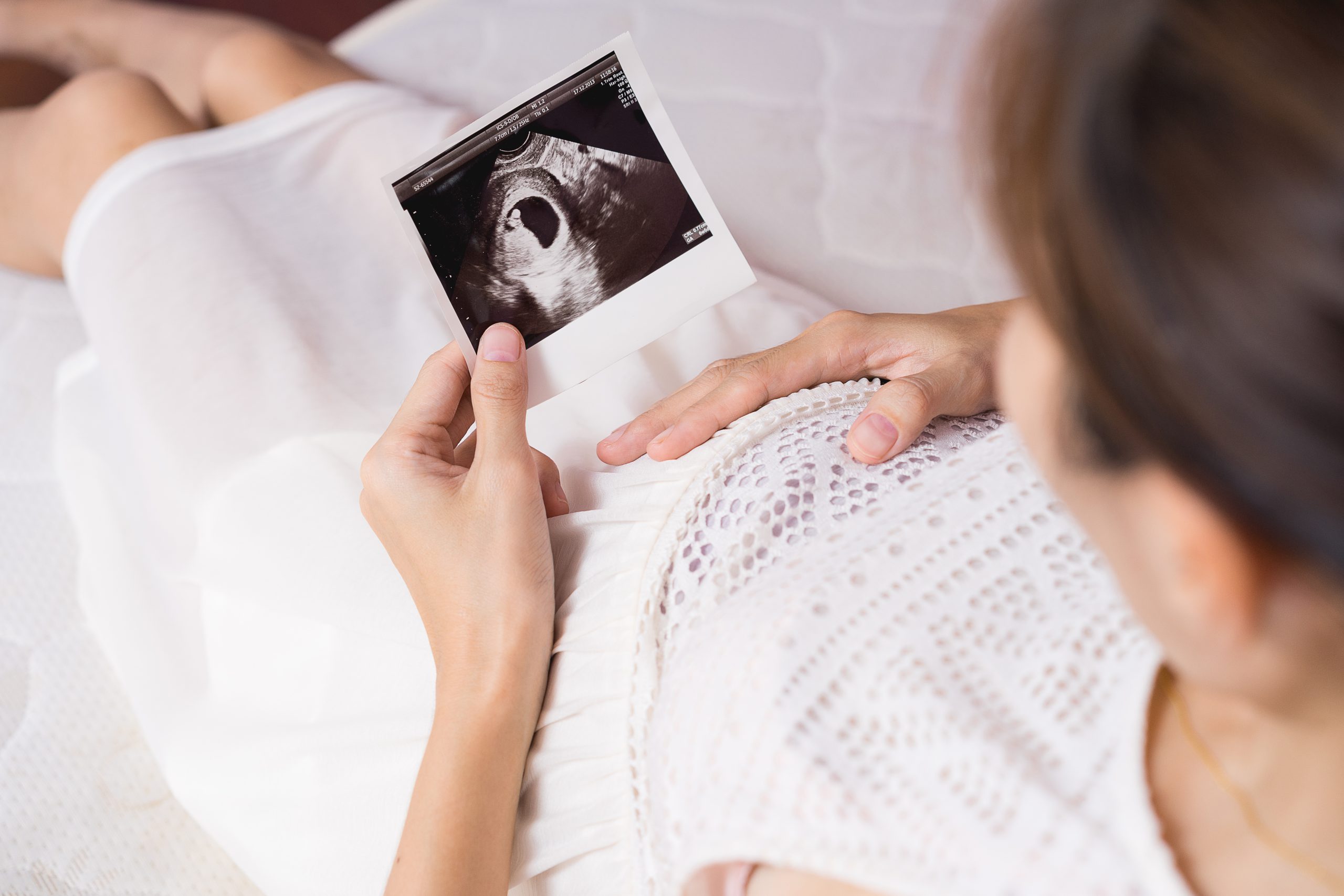 siêu âm thai nhiều lần không ảnh hưởng tới sức khỏe thai kỳ