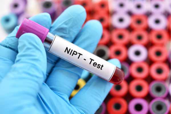 xét nghiệm NIPT bao lâu có kết quả là thắc mắc của nhiều mẹ bầu