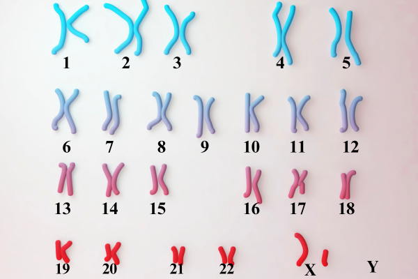 bất thường nhiễm sắc thể có di truyền không?